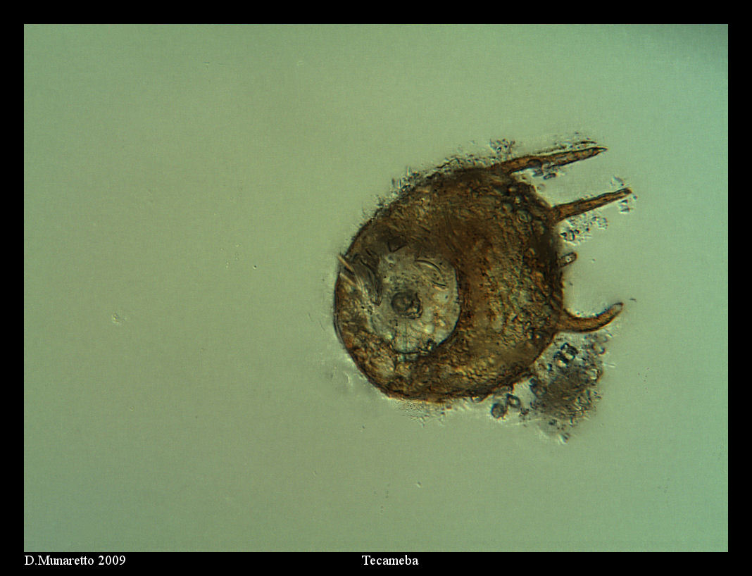 Centropyxis aculeata